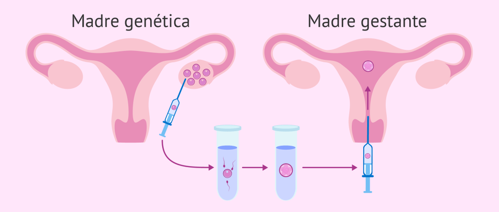 proceso-del-metodo-ropa