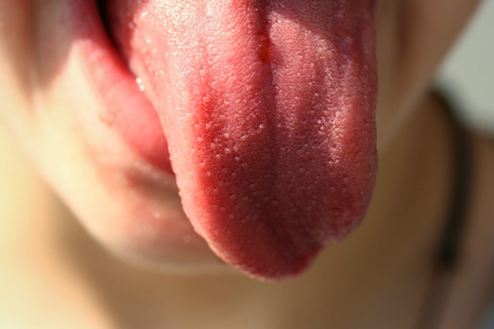 imagen 3.jpg